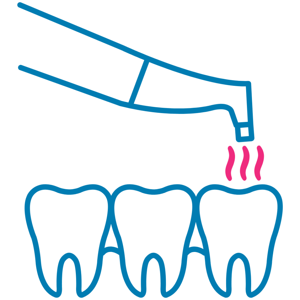 Igiene Orale Con Micro-Polveri