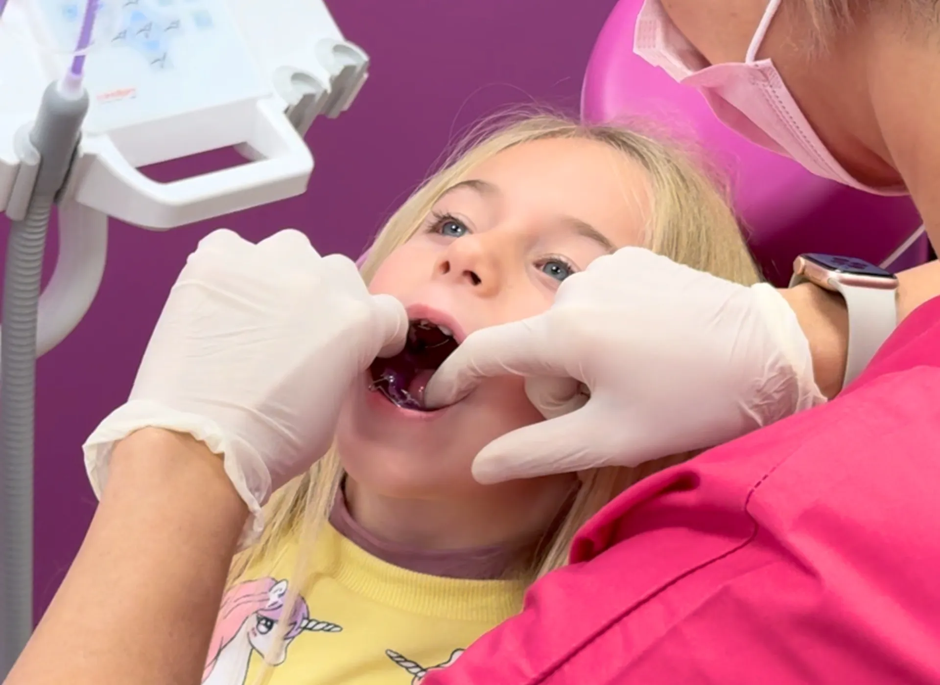 Quando iniziano a cadere i denti da latte