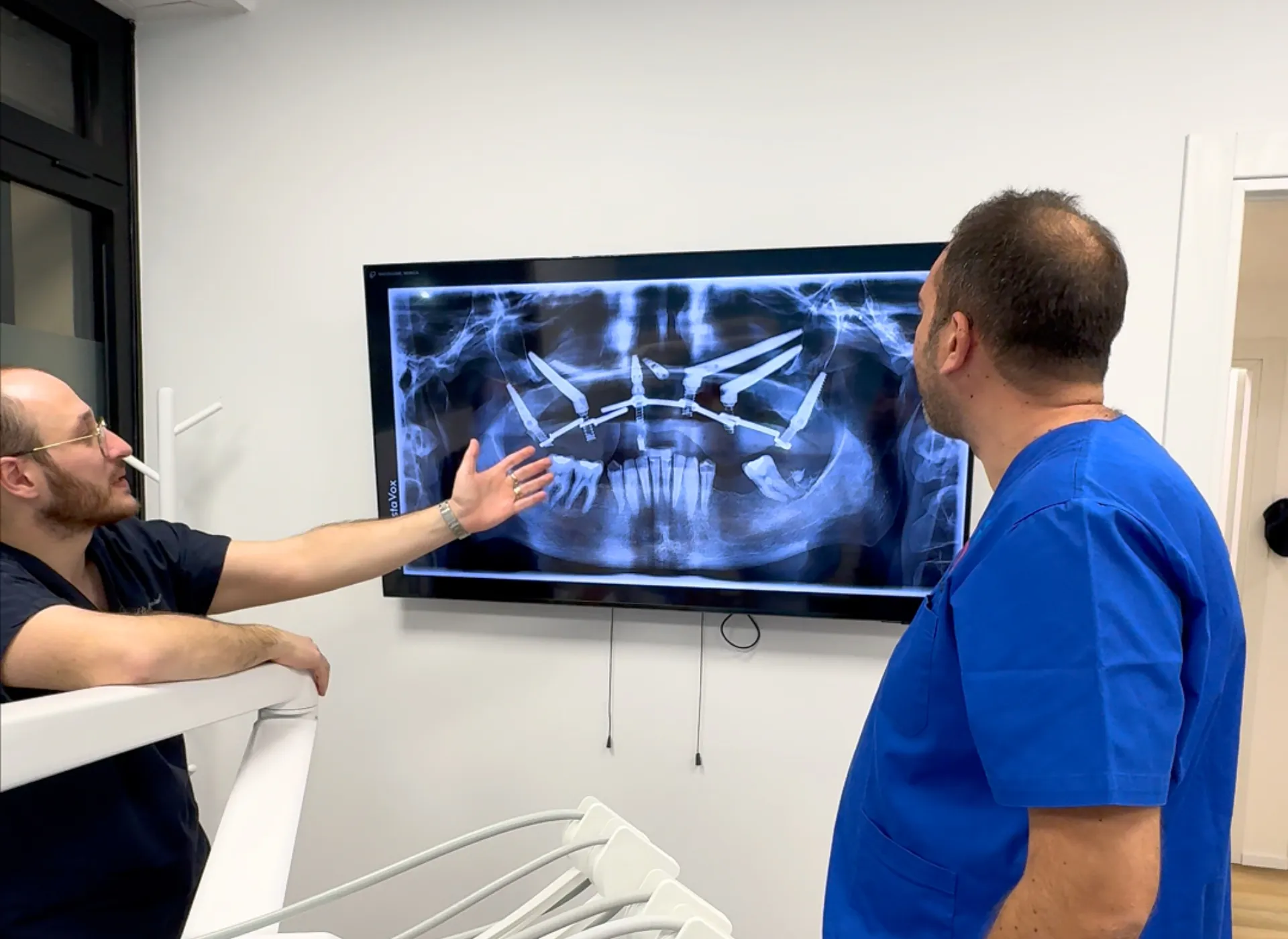 costi degli impianti dentali