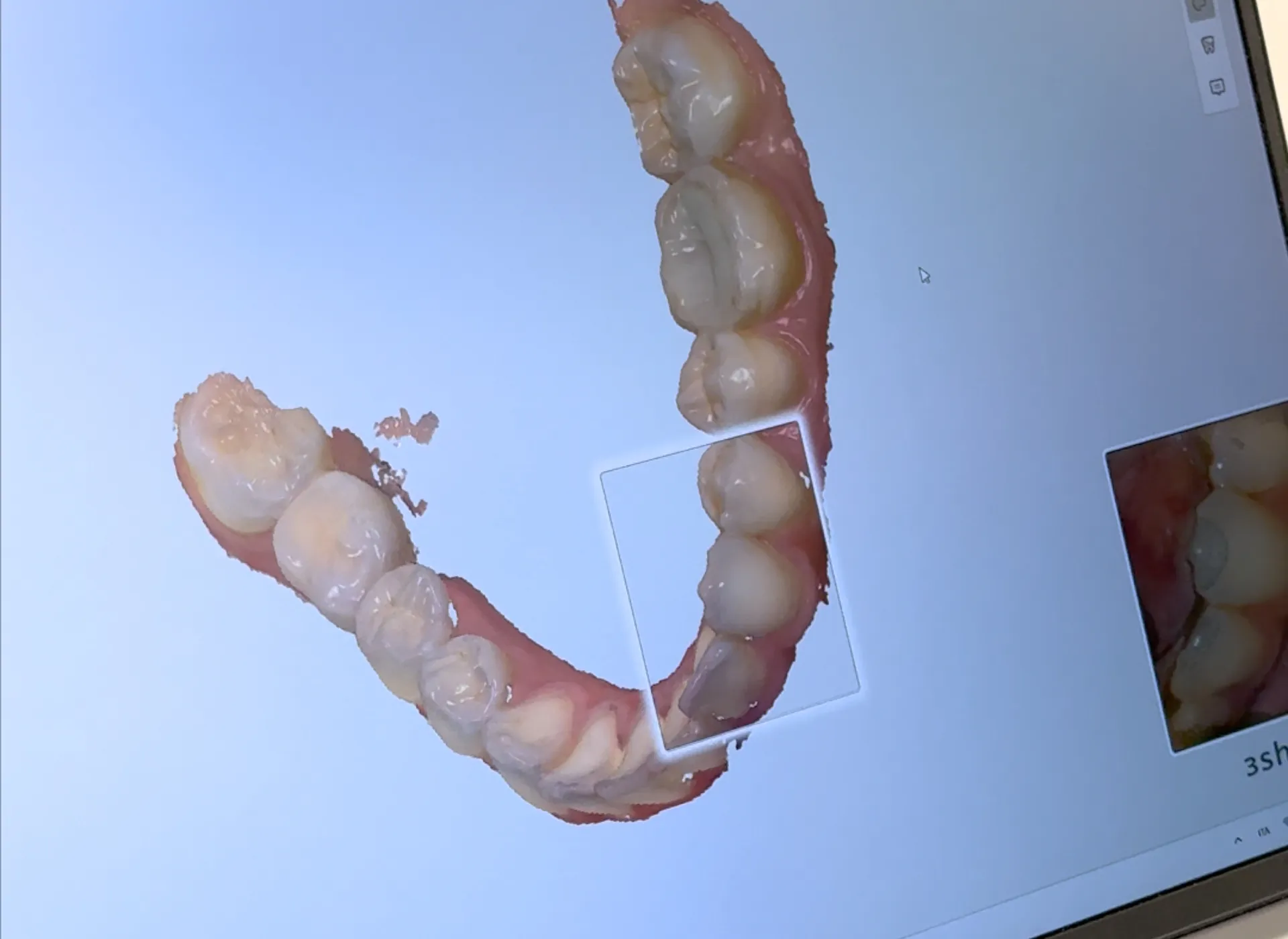 Differenze tra apparecchio messo da bambini e da adulti