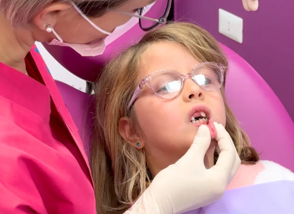 Quando iniziano a cadere i denti da latte