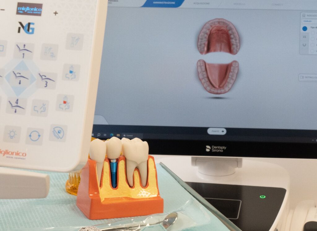 quanto dura un impianto dentale