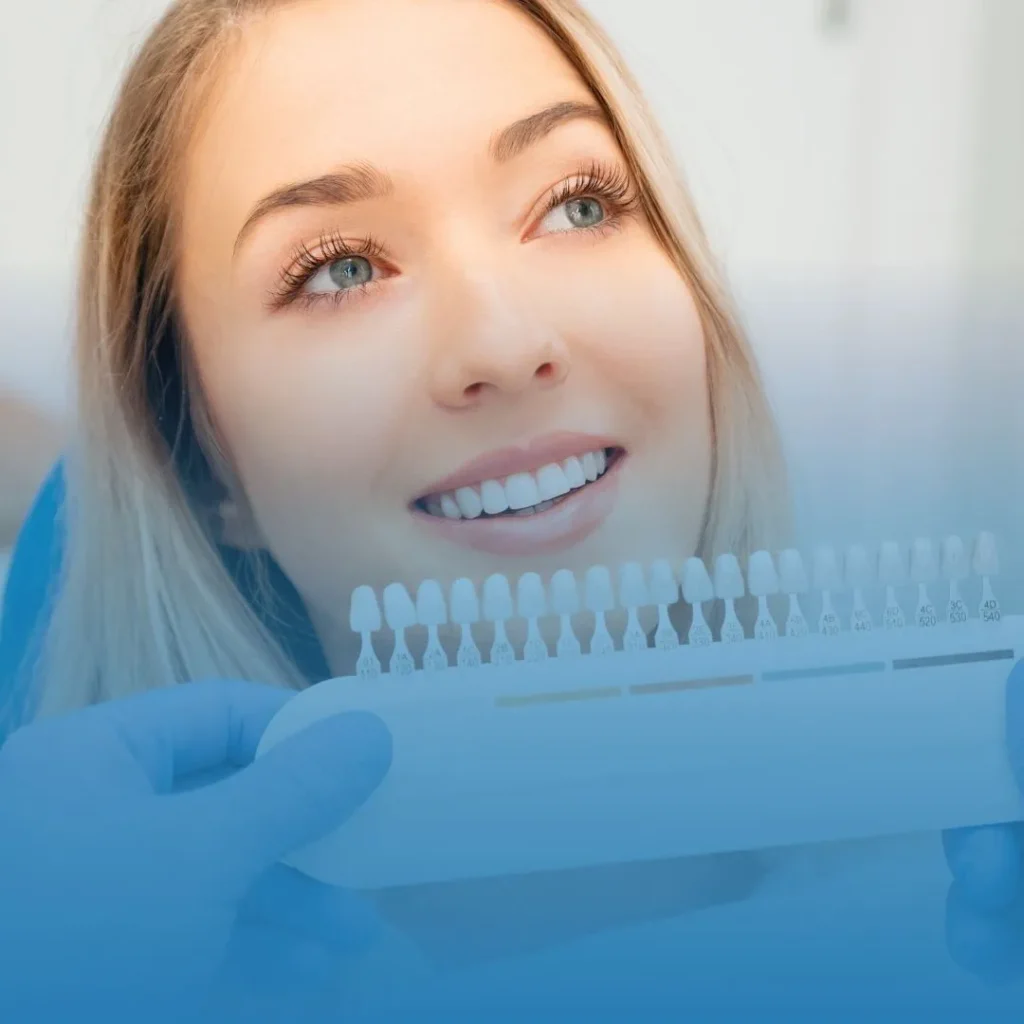 Faccette dentali a Casal Monastero