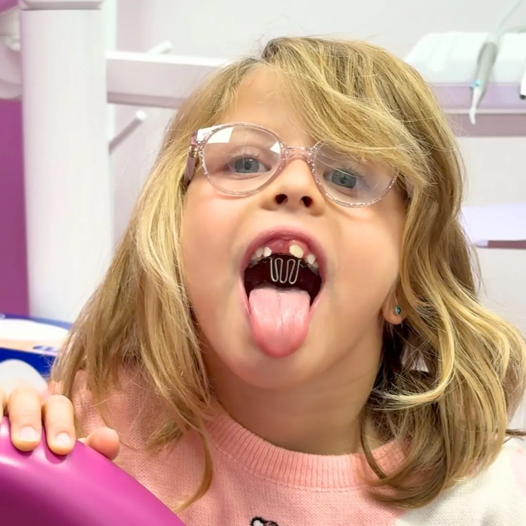 Differenze tra apparecchio messo da bambini e da adulti