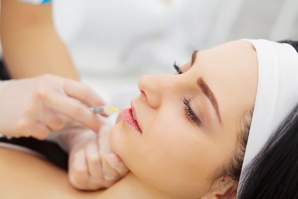 Filler labbra per aumentare il volume in modo naturale
