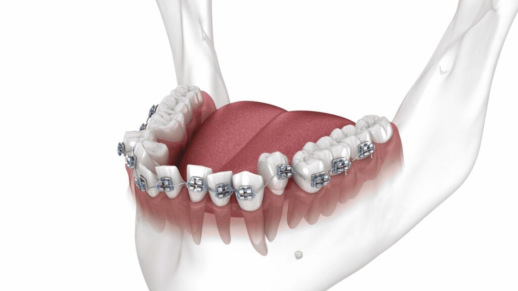 Apparecchio fisso a Casal Monastero